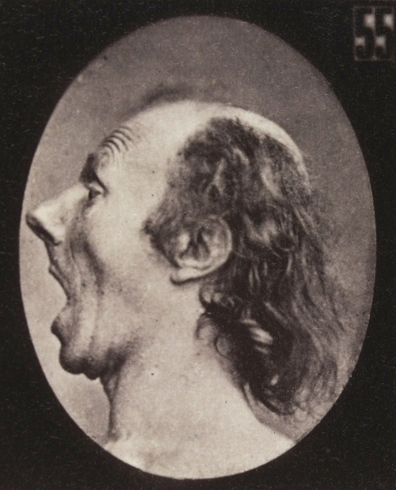 Illustration for article titled Terrifying, Century-Old Photographs from Neuroscience Experiments